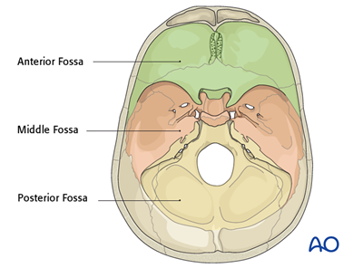 Skull base fracture, anterior