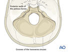 skull base posterior