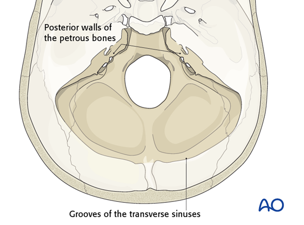 Diagnosis skull base fractures