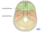 skull base lateral
