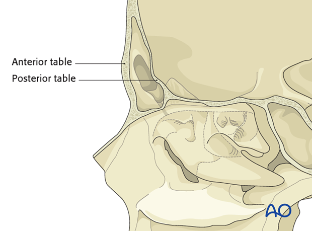 Diagnosis of frontal sinus fractures