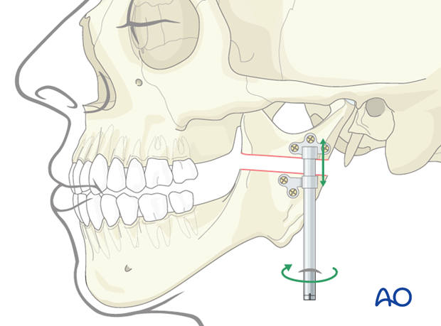 裁断済み藤本研修会　Occlusion & Prosthodontics 2 藤本研修会 Standard Textbook 2 Occlusion & Prosthodontics