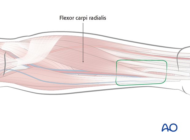 radial forearm fasciocutaneous flap