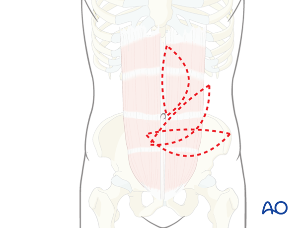 rectus abdominis