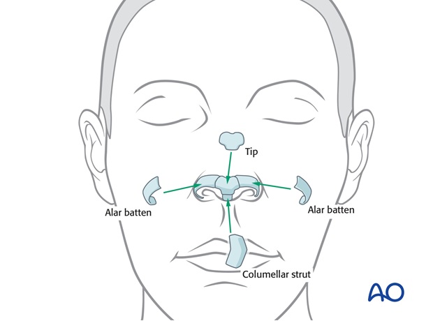 Nose Reconstruction by Dr. Frederick J Menick