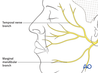 Observation for Reversible paralysis