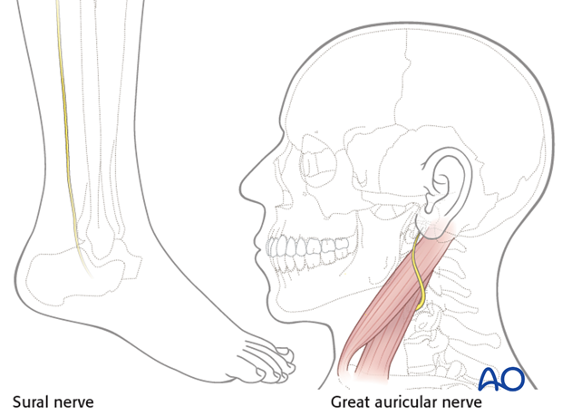 interpositional nerve graft