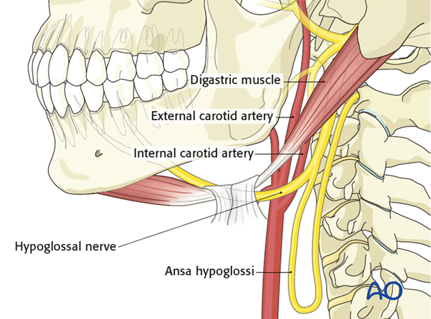 reinnervation with hypoglossal nerve