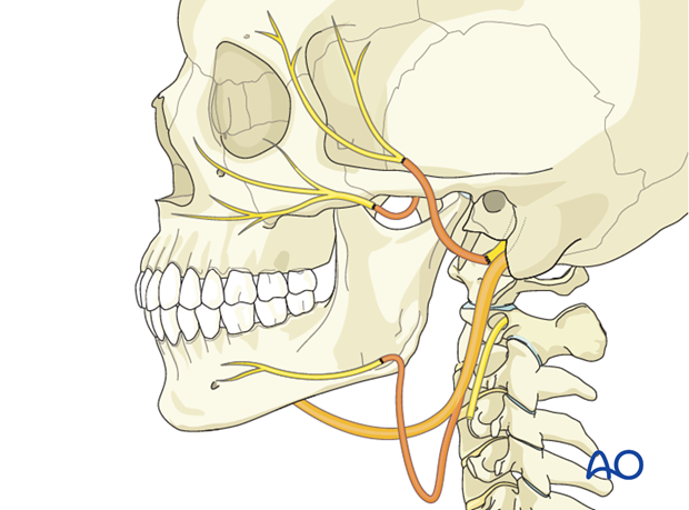 selective reinnervation with proximal facial nerve and masseteric nerve