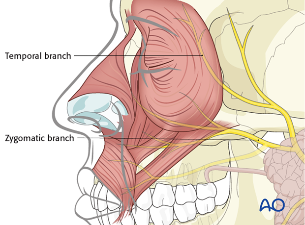 anatomy of the facial nerve