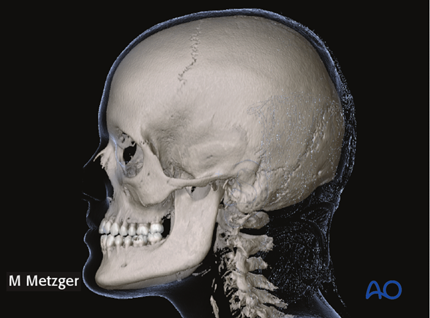 cas asymmetry correction asymmetry