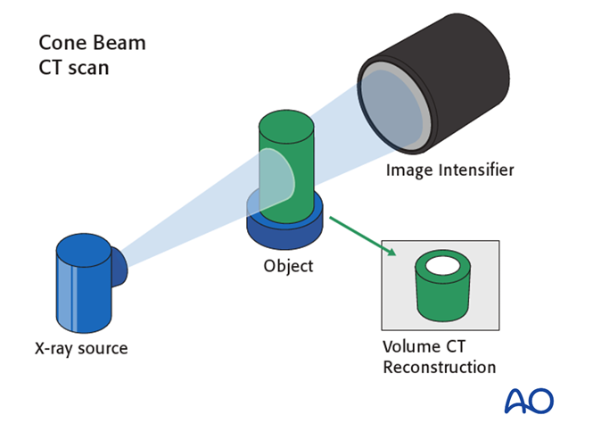 Cone beam vs. fan beam CT