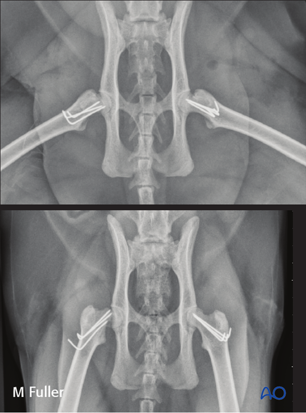 prognosis and complications with proximal femoral fractures