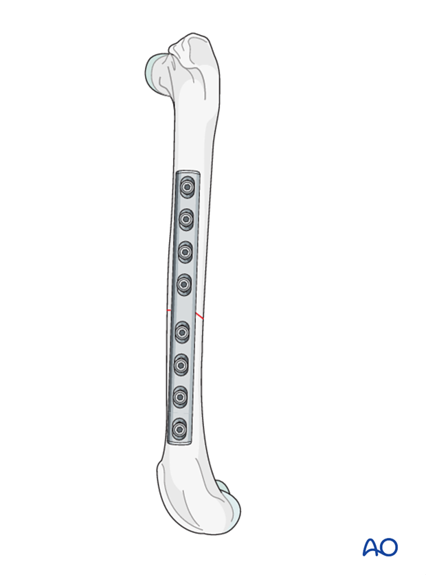 32 A3
