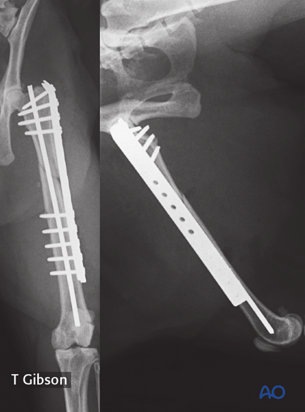 plate and rod