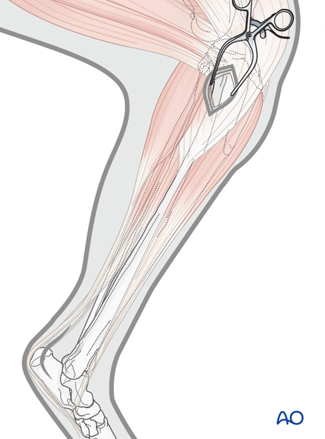 Approach Tibia Cat Approaches for minimally invasive osteosynthesis (MIO) to the cat ...