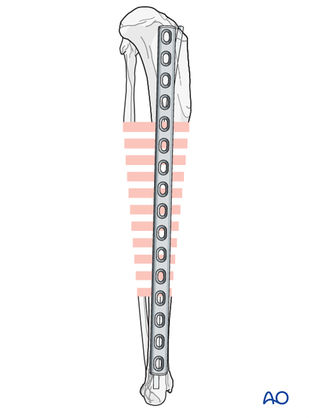 plate and rod