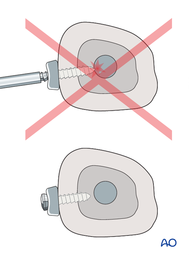 plate and rod