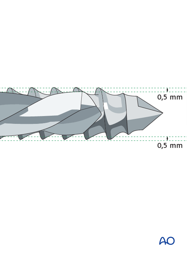 external fixator