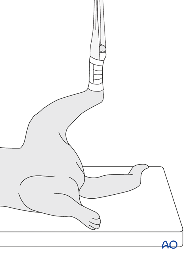 dorsal recumbency hanging limb