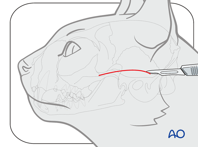 Lateral approach to the temporomandibular joint