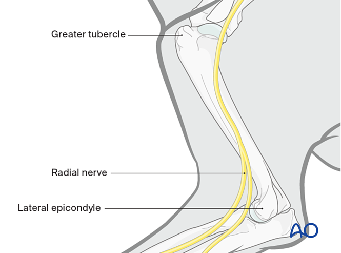 Lateral approach to the dog humeral shaft