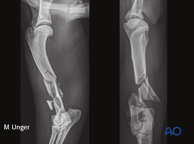 Preoperative radiographs 