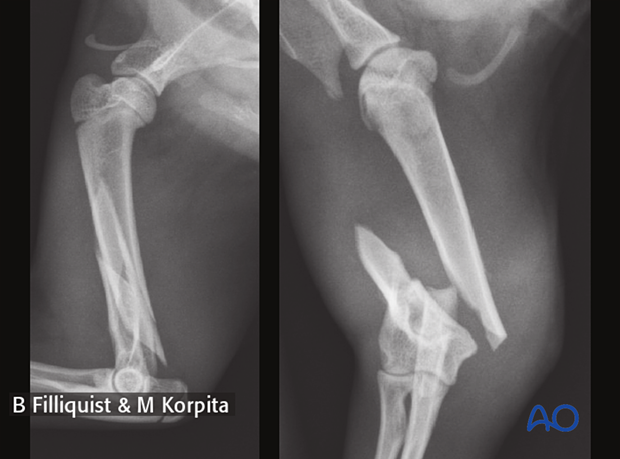 Preoperative radiographs