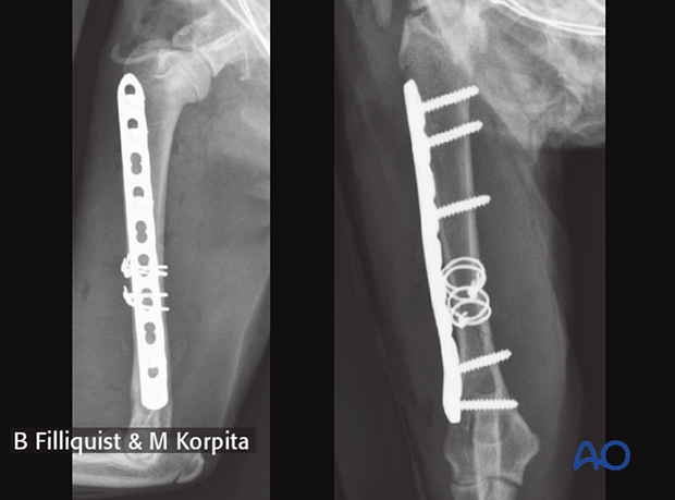 Postoperative radiographs