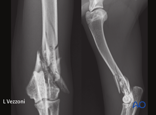 Preoperative radiograph