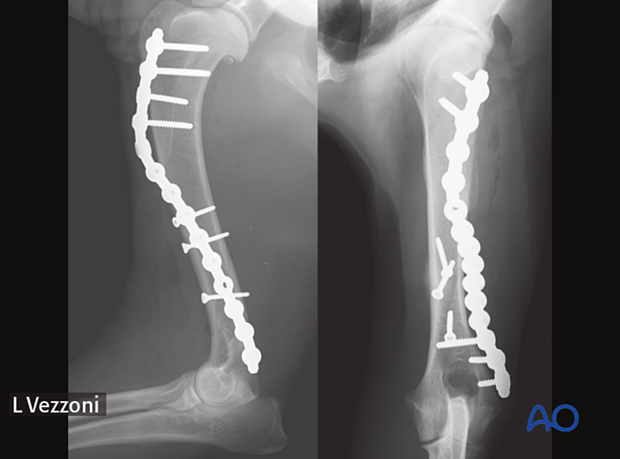 Postoperative radiographs