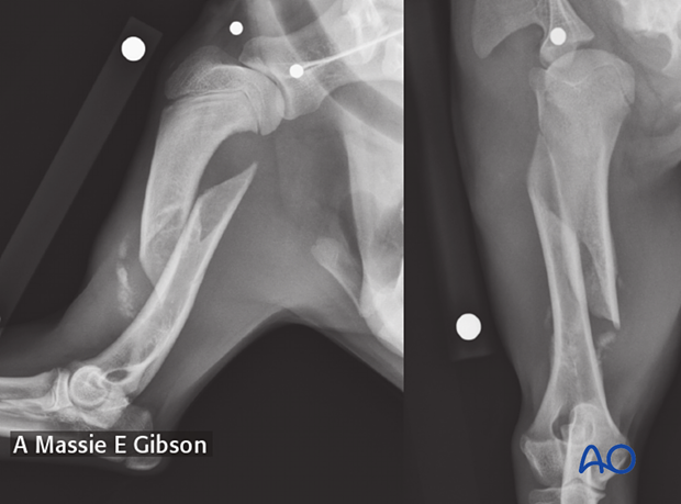 Preoperative radiographs