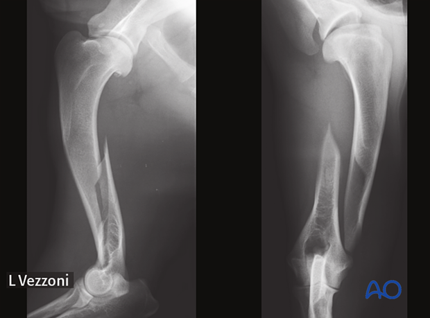 Preoperative radiographs