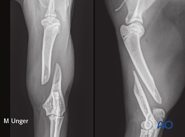 Preoperative radiographs