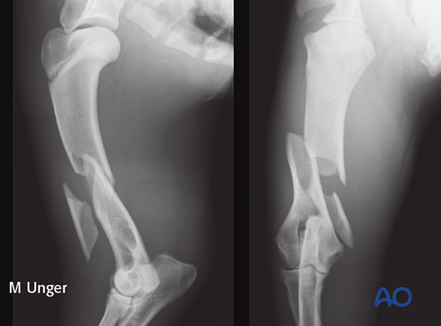 Preoperative radiographs