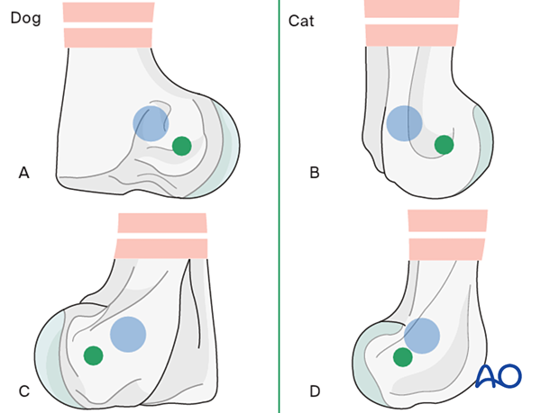 Landmarks for the ideal placement of transcondylar distal pins for external fixators