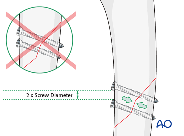 Care must be taken not to place the screws too close to each other