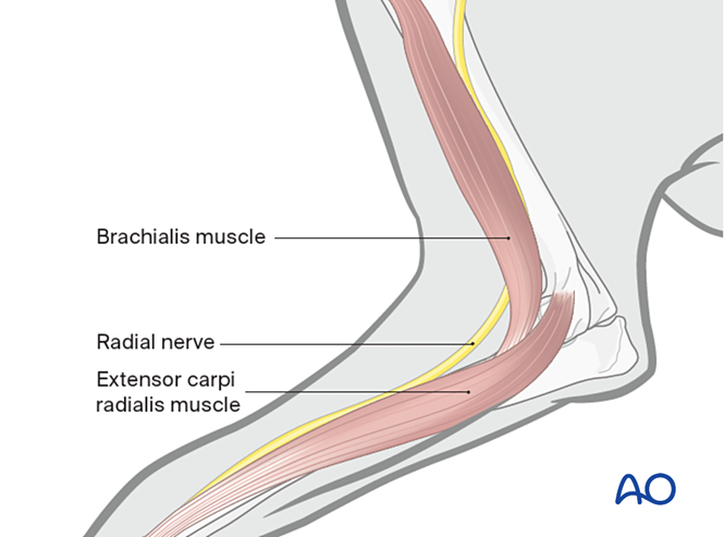 Lateral approach to the dog distal humerus