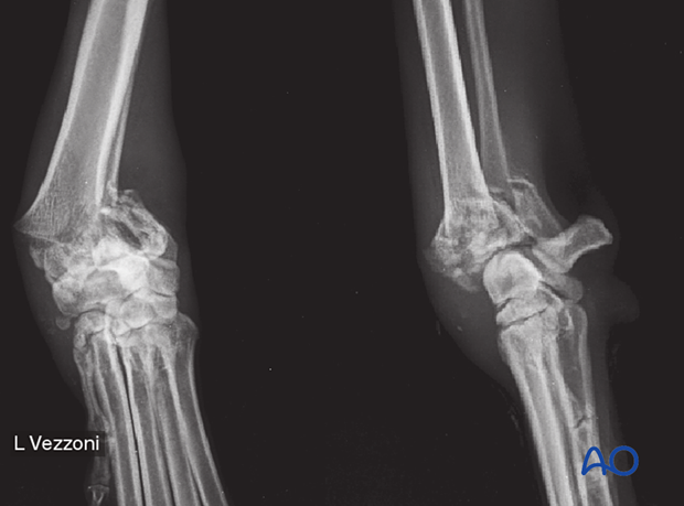D23_P210_i380 23-C3 fracture in a 3-year-old dog