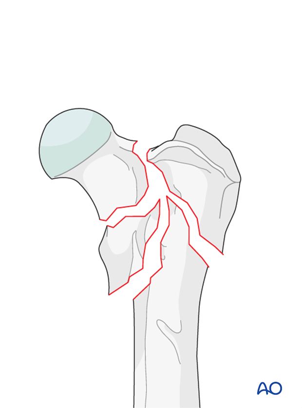 D31_D00_i240 definition