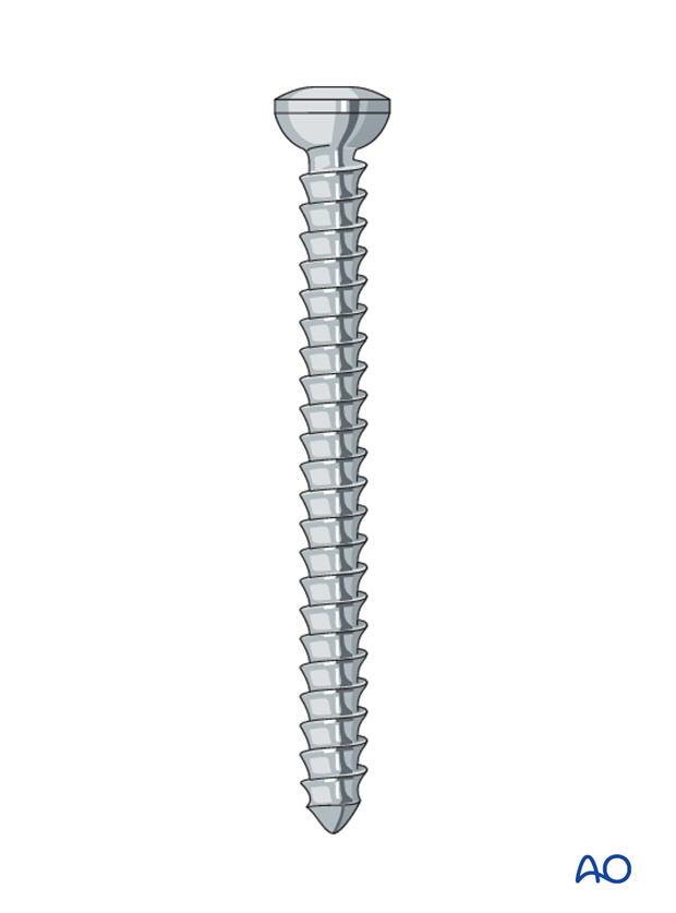 lag screw and k wire