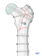 31 A3