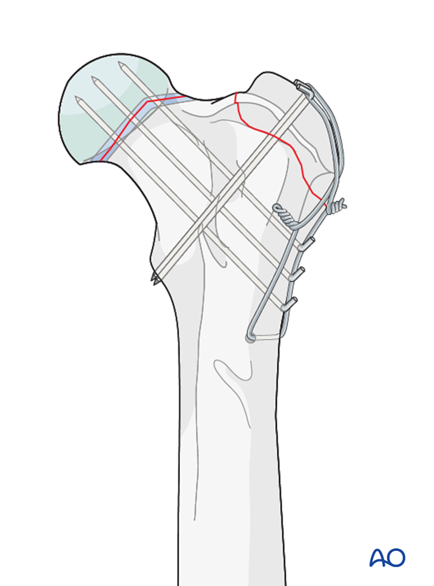 combined treatment options