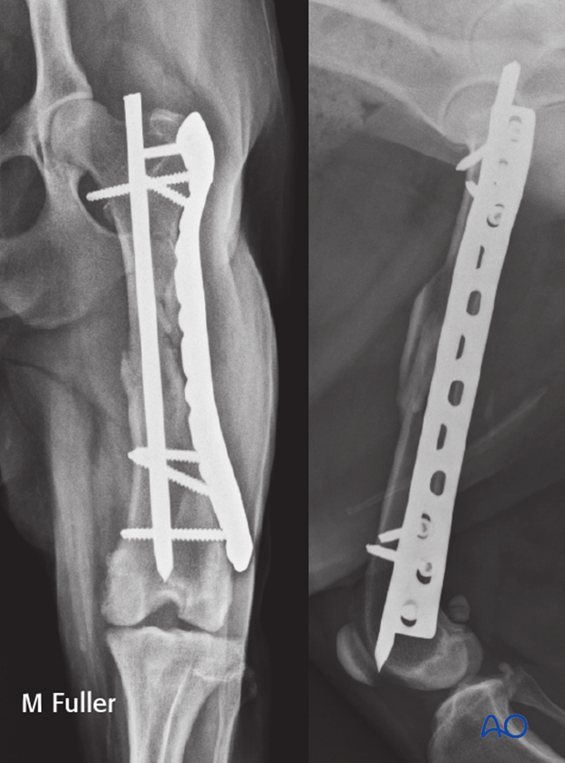 plate and rod