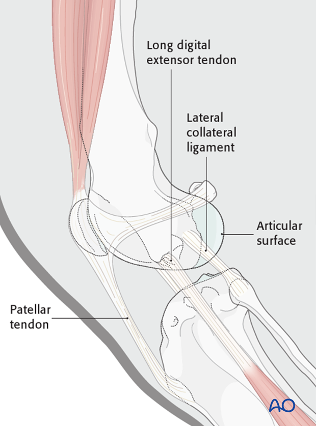 D33_A00_i040 Dog distal femur anatomic landmarks for lateral parapatellar approach