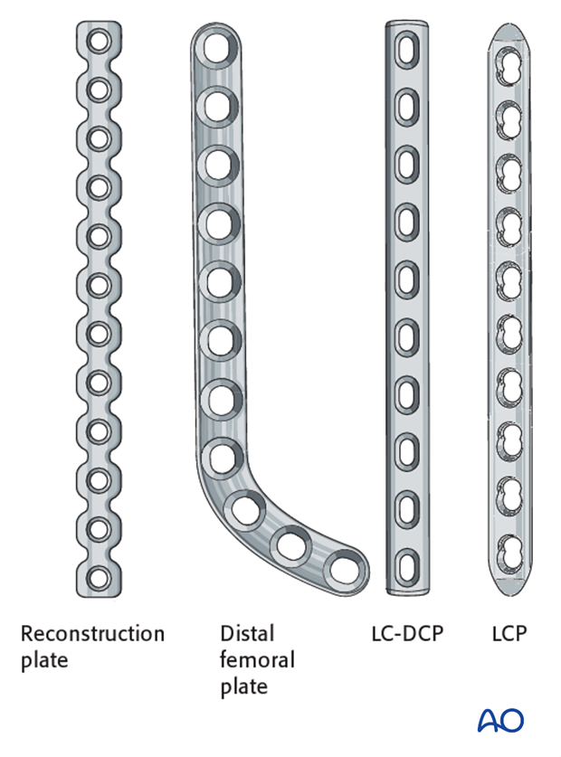 Numerous plate types can be used to repair a type A fracture in a dog distal femur