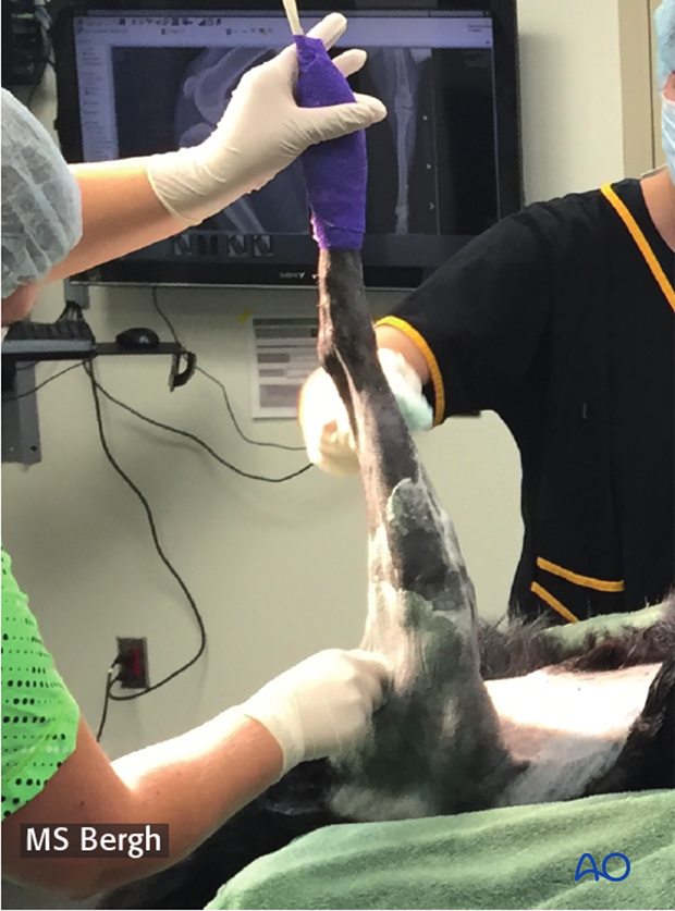 D33_PO10_i080 Non sterile wrap