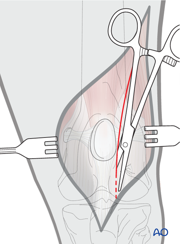 Image link Alt