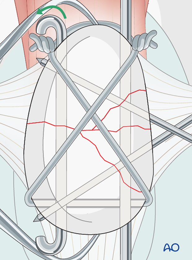 Image link Alt placeholder