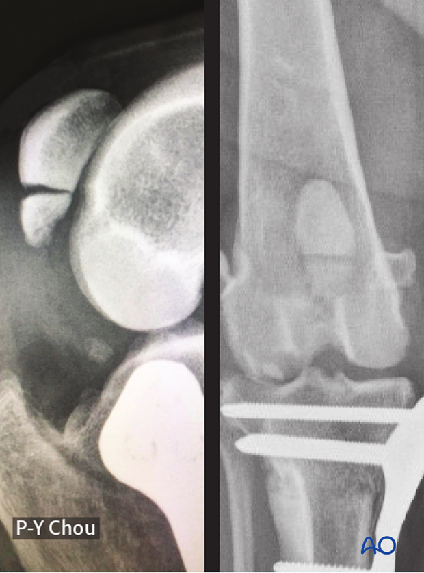 Radiograph of the stifle joint